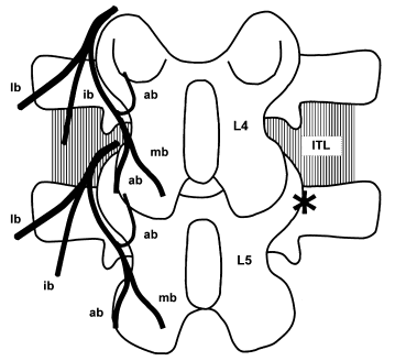 Branches of the lumbar dorsal rami at the levels of L4 and L5. mb, medial branch; ib, intermediate branch; lb, lateral branch; ab, articular branch; ITL, intertransverse ligament. *A target point of total dorsal ramus block.[1] 2007 Elsevier Masson SAS. All rights reserved.