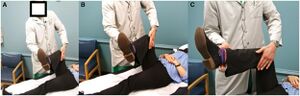 The resisted internal rotation test. Patient is supine with affected hip and knee at 90° flexion and hip at 10° internal rotation. The patient actively internally rotates the hip against resistance (knee away and foot towards examiner in photo). The test is positive with pain reproduction or weakness.[8]