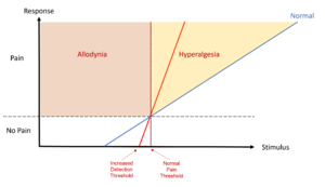 Hyperpathia increased DT normal PT hyperalgesia.png