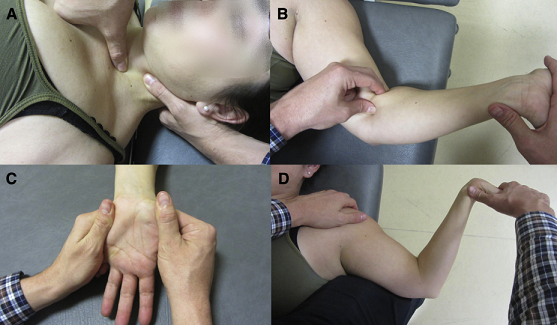 File:CTS manual therapy.png