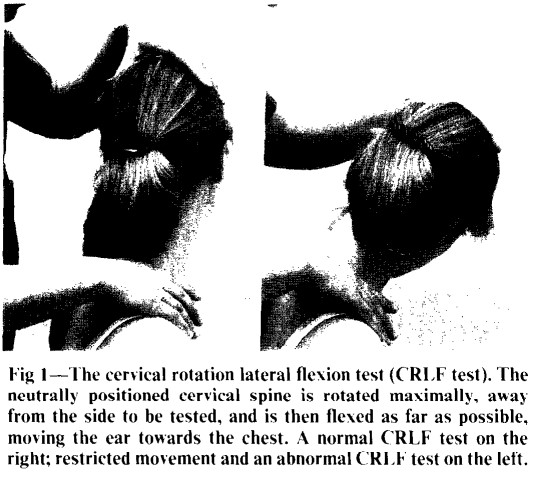 File:Cervical Rotation Lateral Flexion Test.jpg