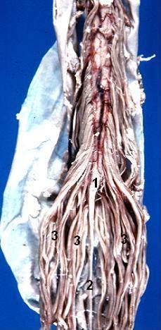 File:Cauda equina anatomy.jpg