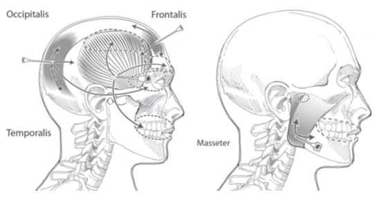 TMJ trigger point injections.PNG