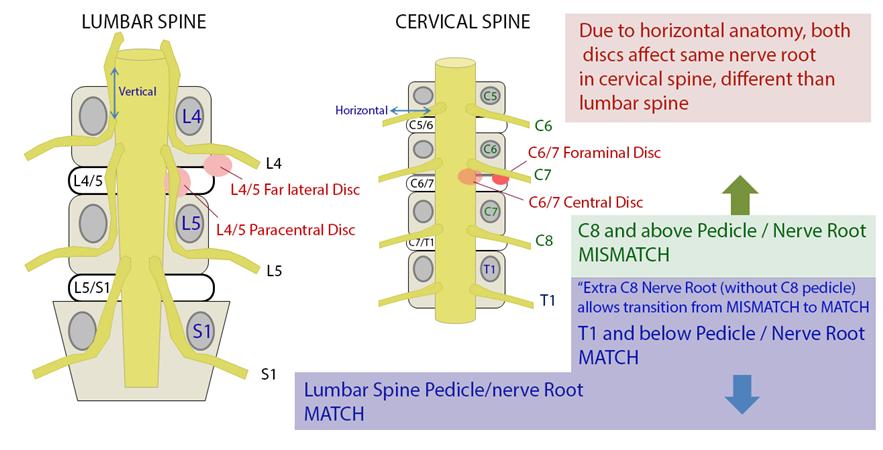 The relationship between nerve roots and spinal anatomy