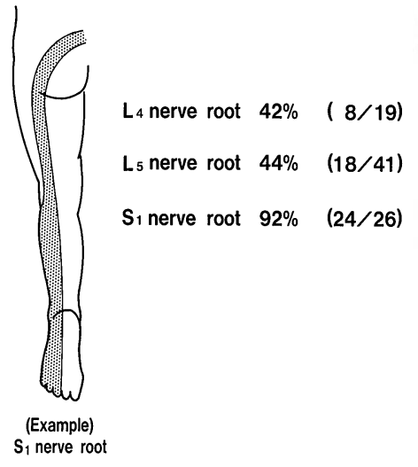 File:L4-S1 nerve block band like Nitta.png