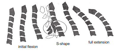 The lower segments extend while the upper segments flex, resulting in an S-shaped deformation in the middle phase.