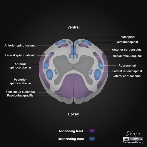File:Incomplete-spinal-cord-syndromes-illustrations.jpg