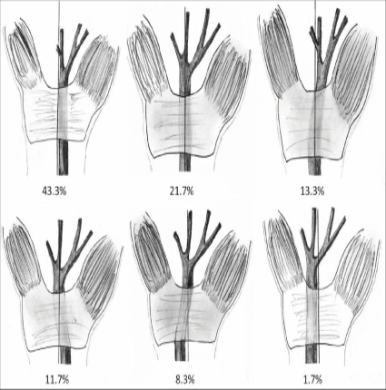 File:Median nerve position variations wrist.png