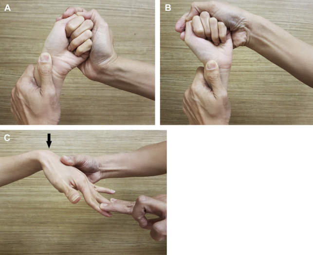 File:Watson and finger extension tests.jpg
