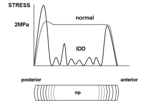 File:IDD vs normal disc stress profilometry.png