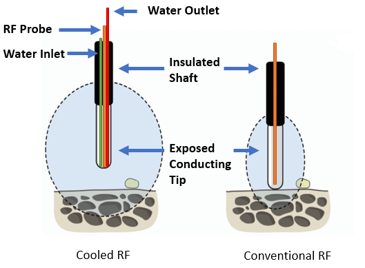File:Cooled vs Conventional RF.png