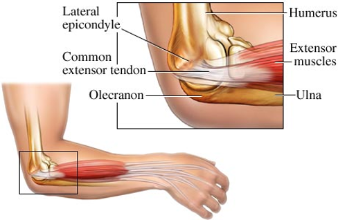 File:Lateral elbow.png