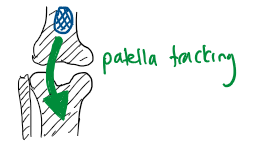 File:Patellar Tracking.PNG