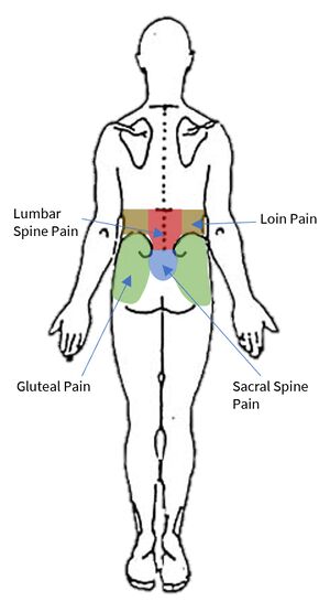 Low back pain taxonomy.jpg