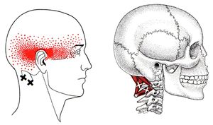 Suboccipital Group