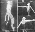 Sherington 1893 - Severing dorsal nerve roots in monkeys