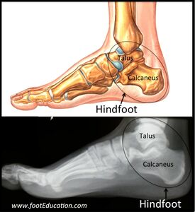 Figure 1: Hindfoot Anatomy