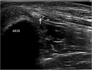 LFCN ultrasound2.jpg
