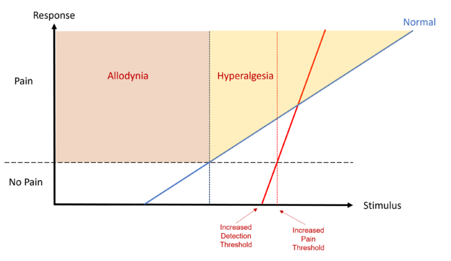 Hyperpathia with increased DT, increased PT, hyperalgesia, and steeper stimulus-response curve as compared to normal.