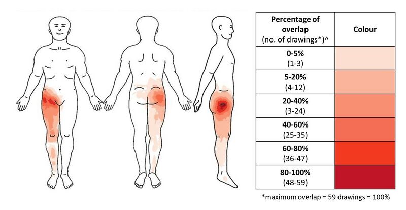 File:Hip OA pain distribution.jpg