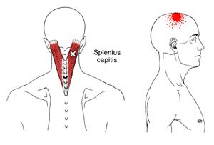 Splenius Capitis, Splenius Cervicis 2