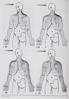 Dynatomal patterns of pain[9]