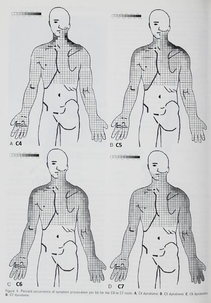 File:Slipman cervical dynatomes.jpg