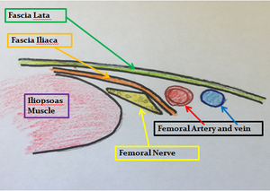 Femoral Nerve block anatomy.png