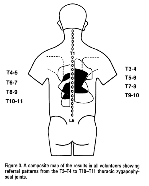 File:Thoracic ZA Joints.PNG