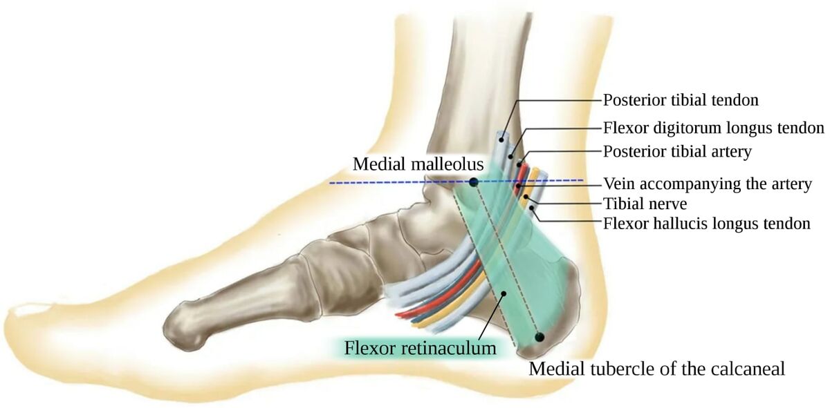 Tarsal Tunnel Syndrome - Triangle Physiotherapy