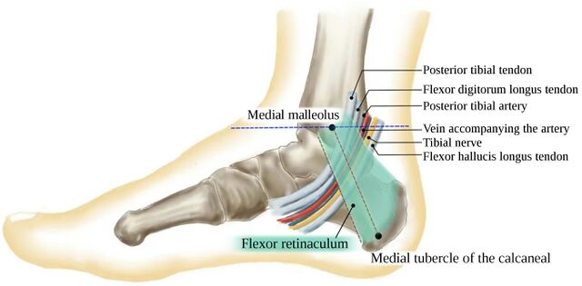 Tarsal Tunnel Syndrome - WikiMSK