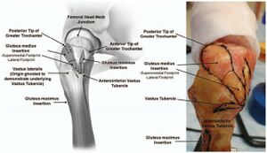 lateral hip with foot prints of gluteus medius, gluteus minimus, and vastus lateralis