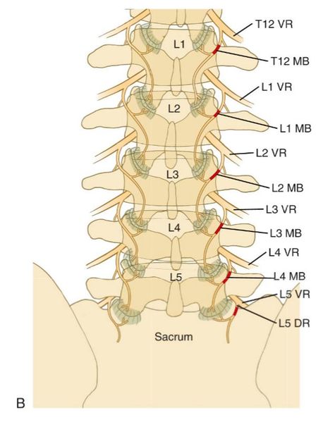 File:Lumbar-medial-branch-nerve-blocks2.jpg