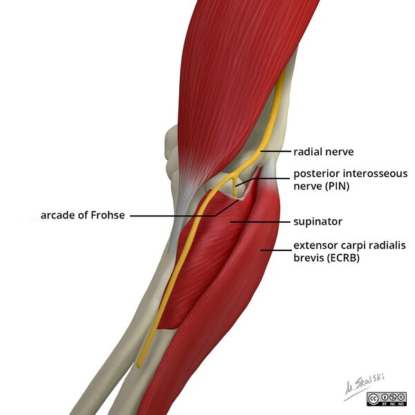 File:Radial nerve elbow.jpg