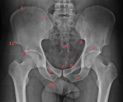 Figure 1: Annotated pelvic x-ray (x-ray from https://radiopaedia.org/cases/pelvic-radiograph-normal-1). 1) Iliac crest; 2) sacro-iliac joint; 3) posterior-inferior iliac spine; 4) roof of acetabulum; 5) inferior pubic ramus; 6) superior pubic ramus; 7) pubic symphysis; 8) sacrum; 9) obturator foramen; 10) ischial tuberosity; 11) anterior inferior iliac spine; 12) anterior superior iliac spine.