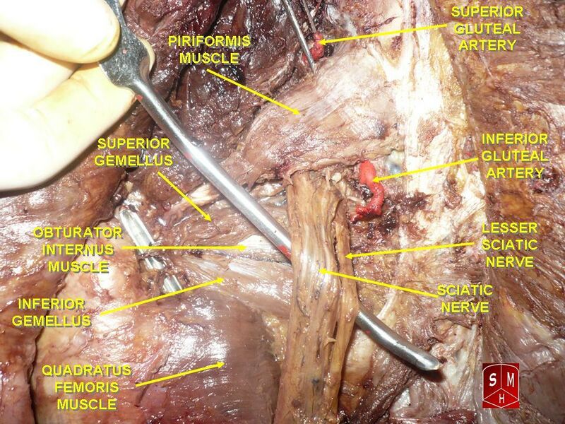 File:Piriformis muscle and sciatic nerve.jpg