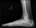 Lateral xray