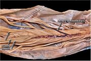 Cadaveric dissection of the artery of Adamkiewicz