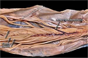 Cadaveric-dissection-of-the-artery-of-Adamkiewicz.jpeg