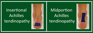 Achilles tendinopathy classification.jpg