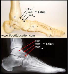Figure 3: Talar Anatomy