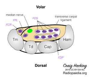Carpal-tunnel-diagram.png