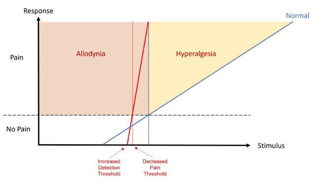 Hyperpathia with increased DT, decreased PT, allodynia, and steeper stimulus-response curve as compared to normal