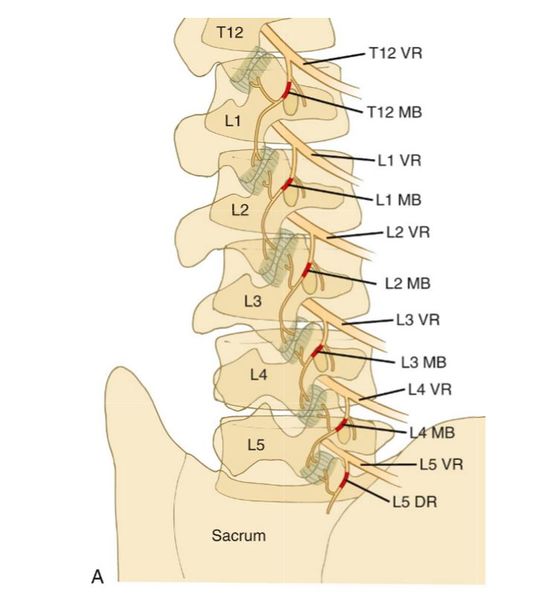 File:Lumbar-medial-branch-nerve-blocks.jpg