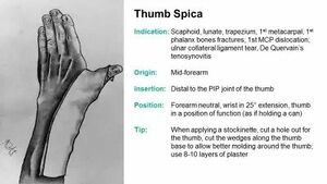 Thumb Spica.jpg