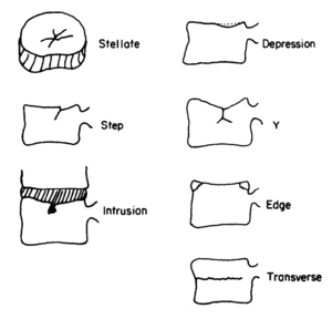 Types of vertebral compressive fracture.png