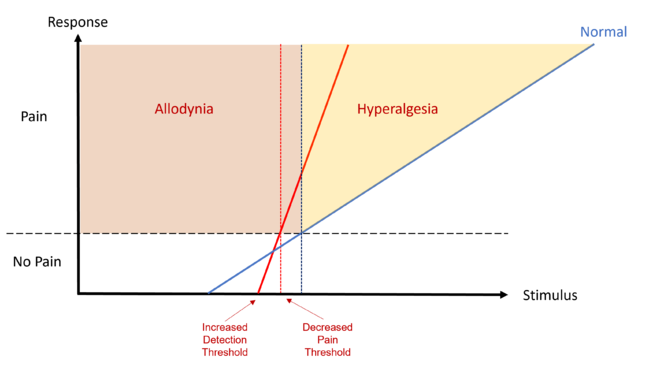 Hyperpathia with increased DT, decreased PT, allodynia, hyperalgesia, and steeper stimulus-response curve as compared to normal.