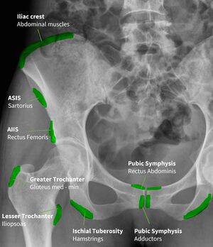 Pelvis and Hip Radiograph Muscle Attachments .jpg