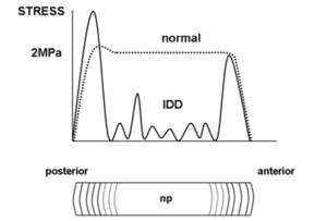 IDD vs normal disc stress profilometry.png