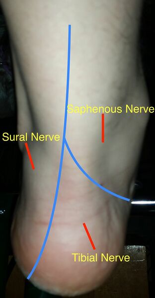 File:Posterior Ankle Nerve Distribution.jpg